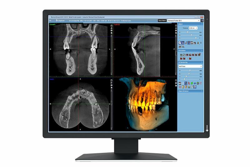 Monitor Consumer EIZO RadiForce MX217-SB, 21", 1200 x 1600 pixeli, Black, 5 ani Garantie